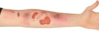 Tattoo Schaafwonden (voorbeeld)