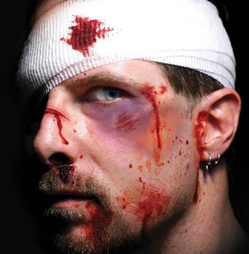 Wond Tattoo FX- Intensive Care