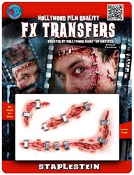 Professionele Wond FX - Staplestein (Nietjes)
